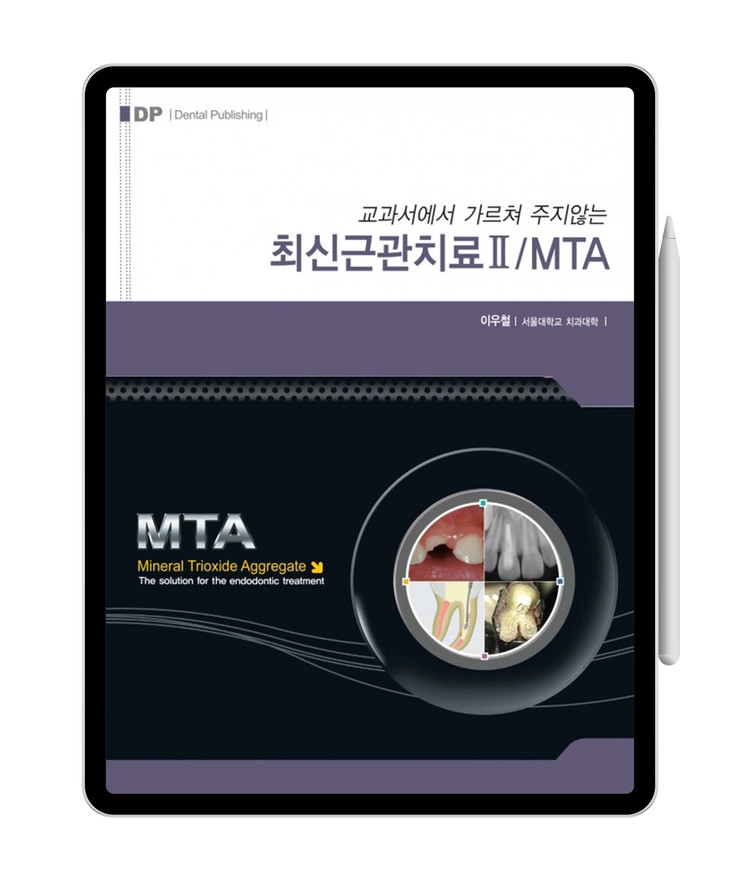 교과서에서 가르쳐 주지 않는 최신 근관치료 I/MTA