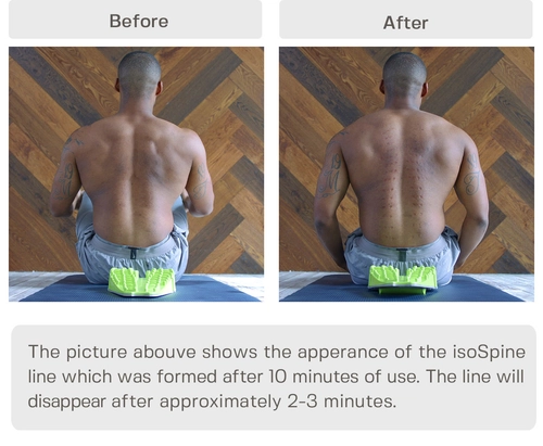 isoSpine(+1 Rolling pad), Back Stretcher for Lumbar Spine, Trigger 
