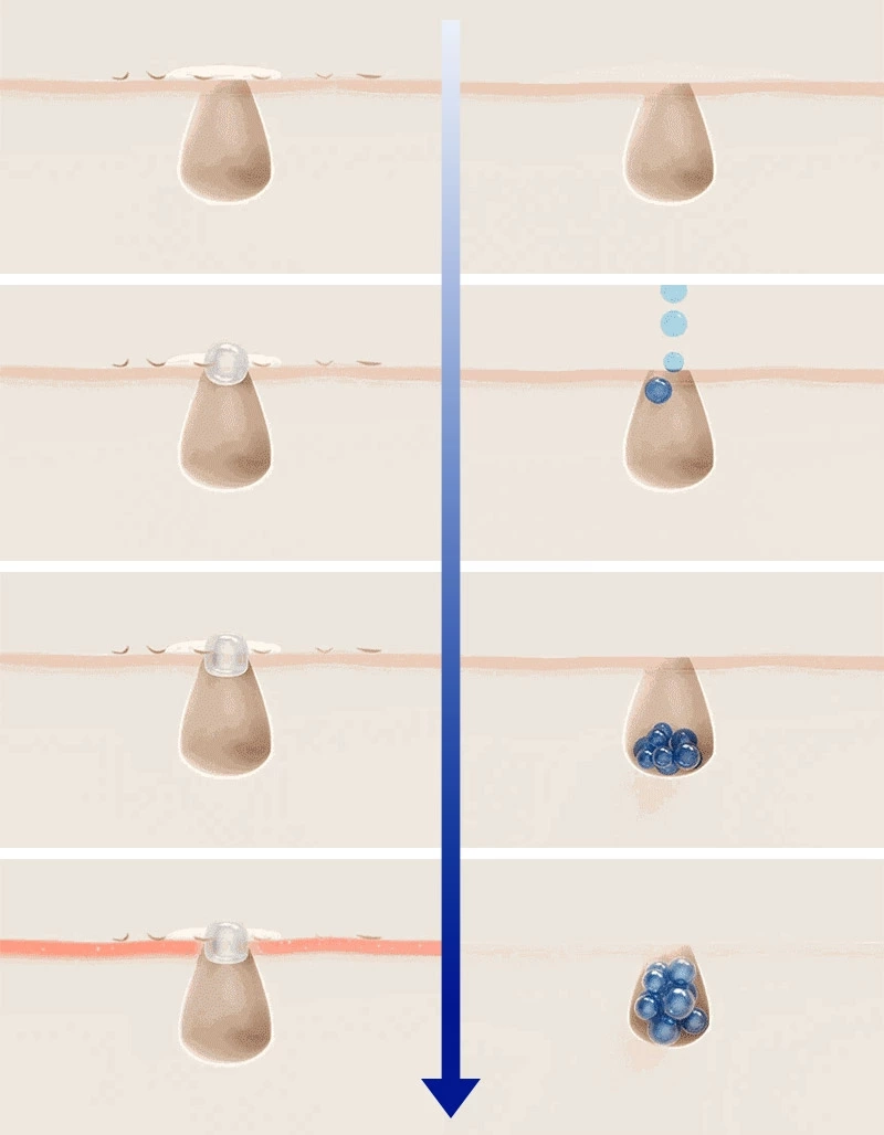 EPL バランシングキュアセラムXD 30ml : Dr.Oracle 日本公式