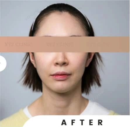 After