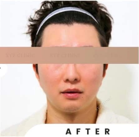 After