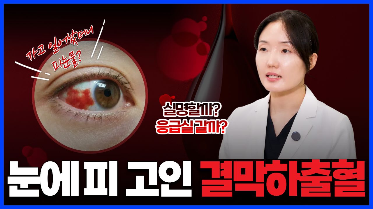 영상 썸네일