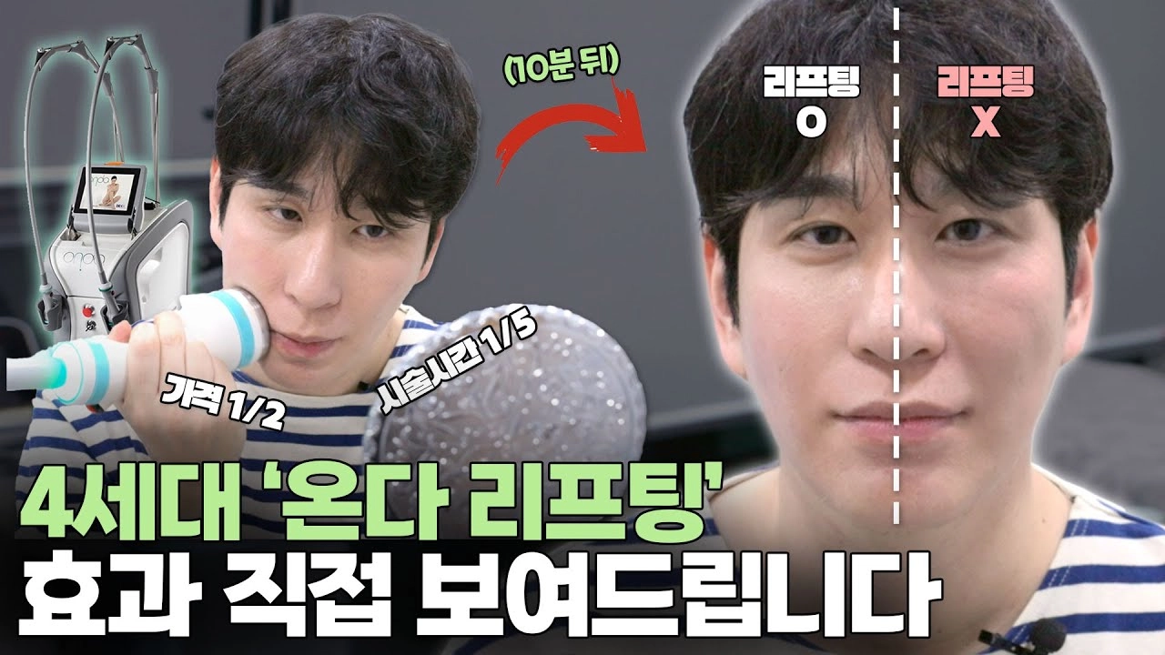  4세대 리프팅레이저는 울쎄라를 넘을 수 있을까? 직접 써본 후기 썸네일