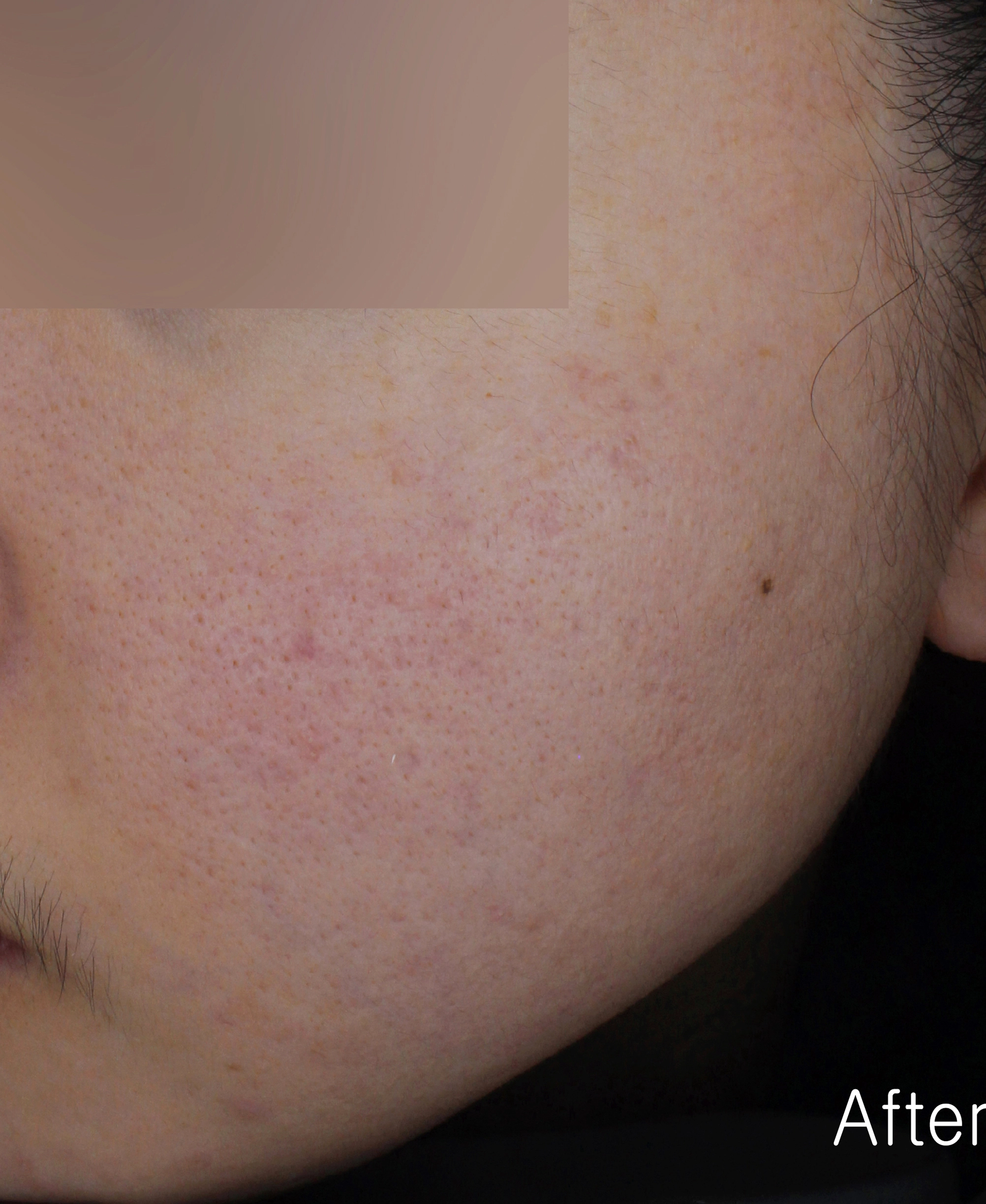 After image for pore and texture example