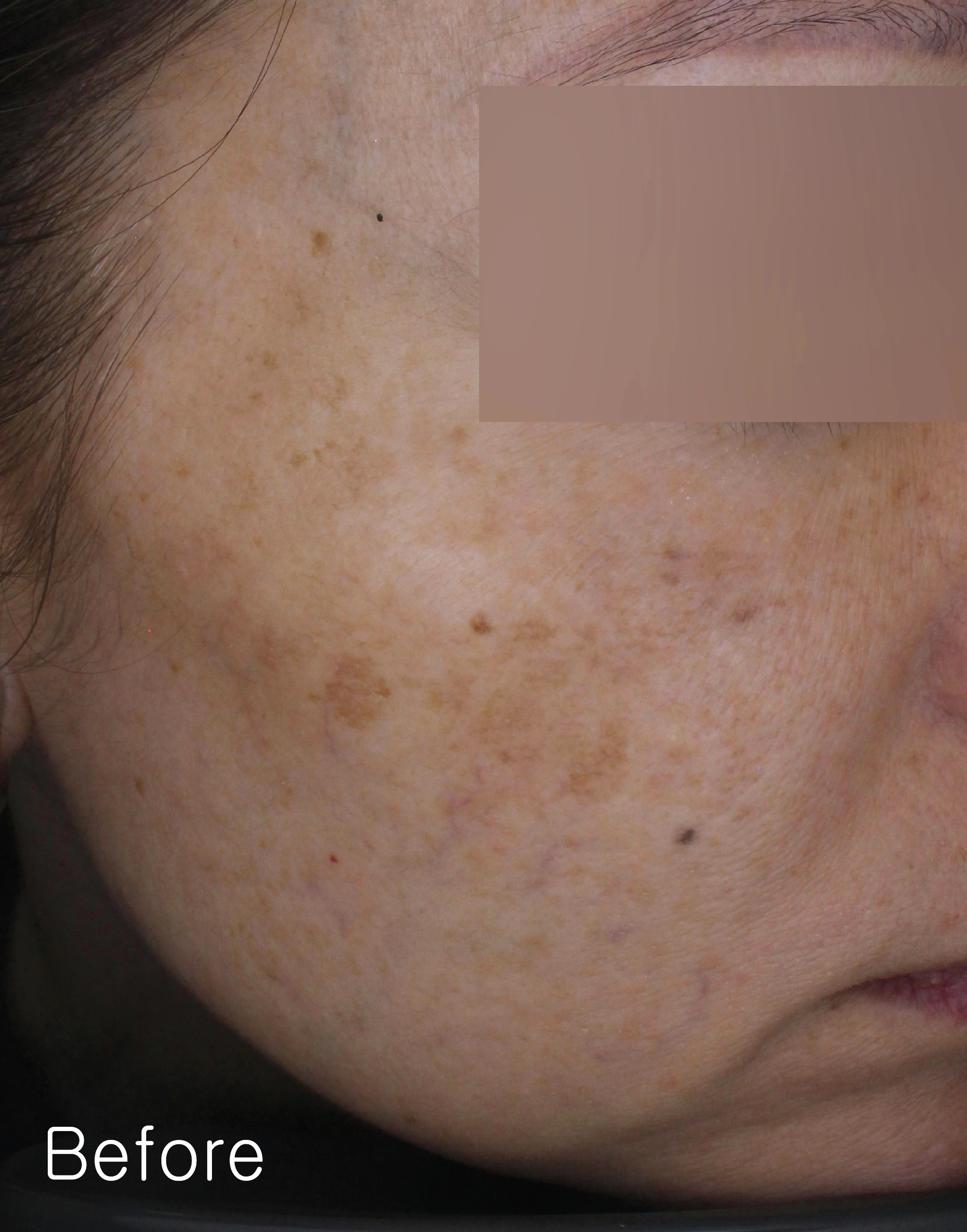 Before image for pore and texture example