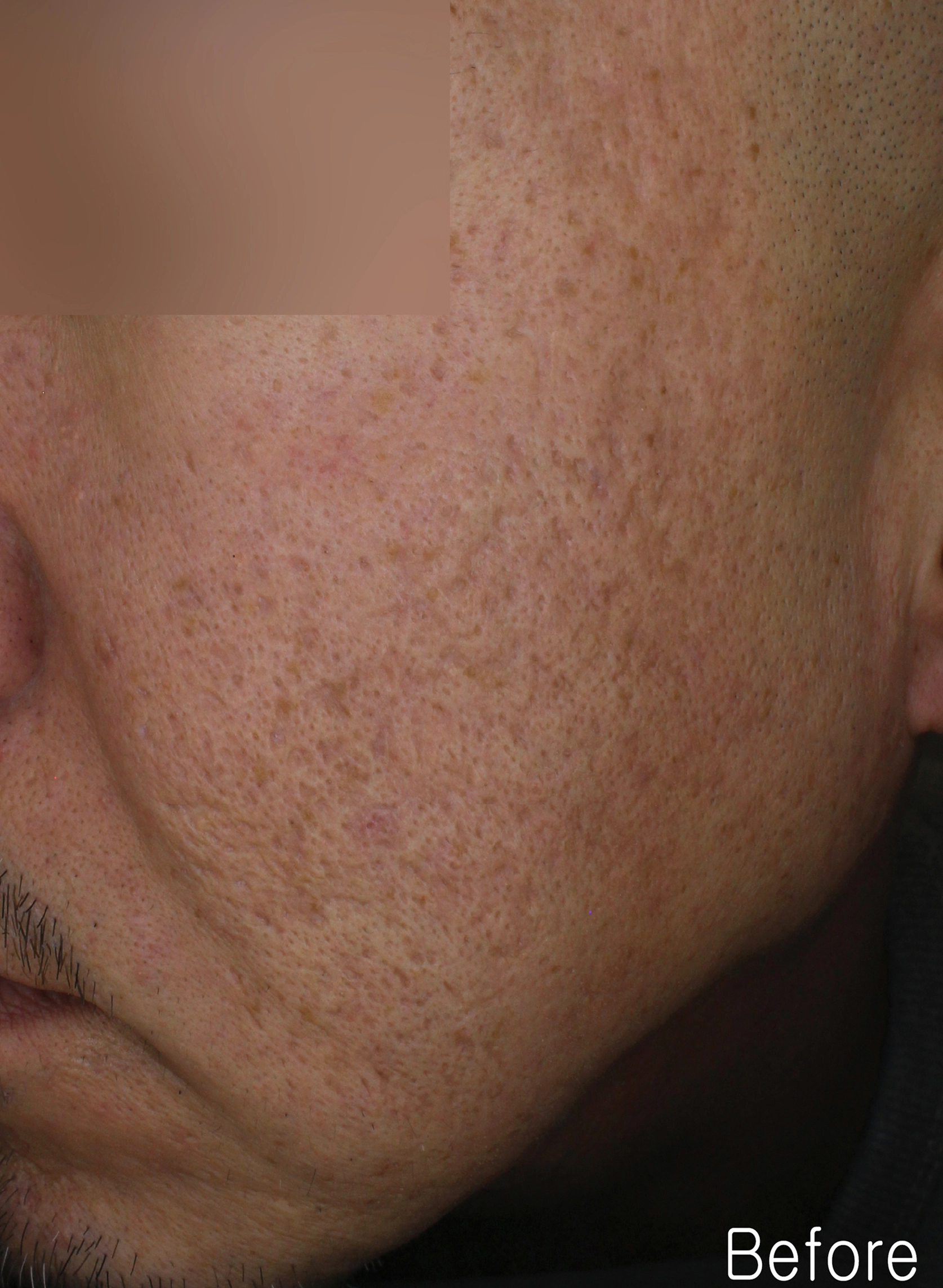 Before image for pore and texture example