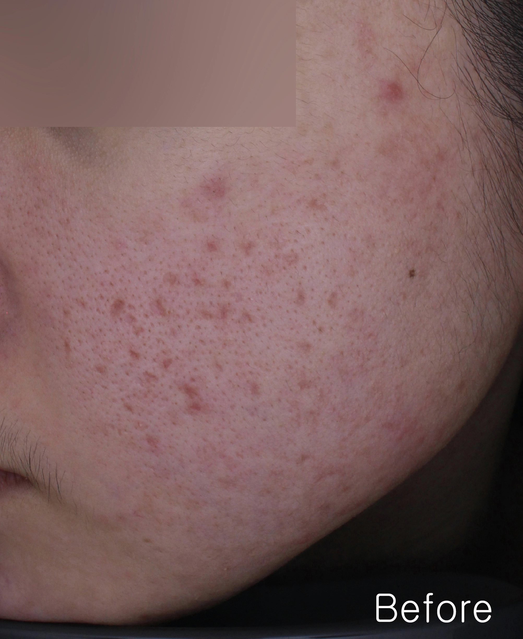 Before image for pore and texture example
