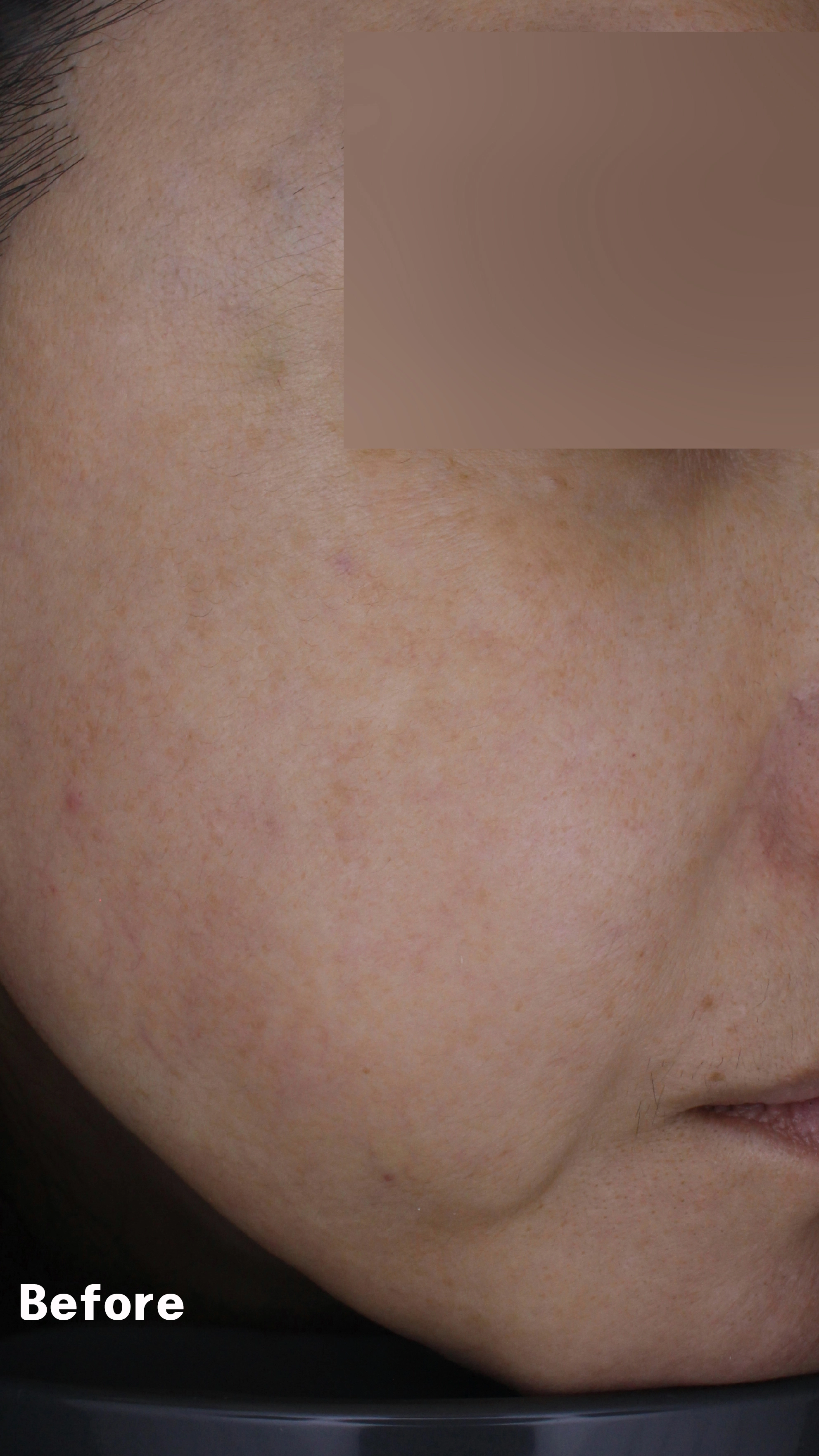 Before image for pore and texture example