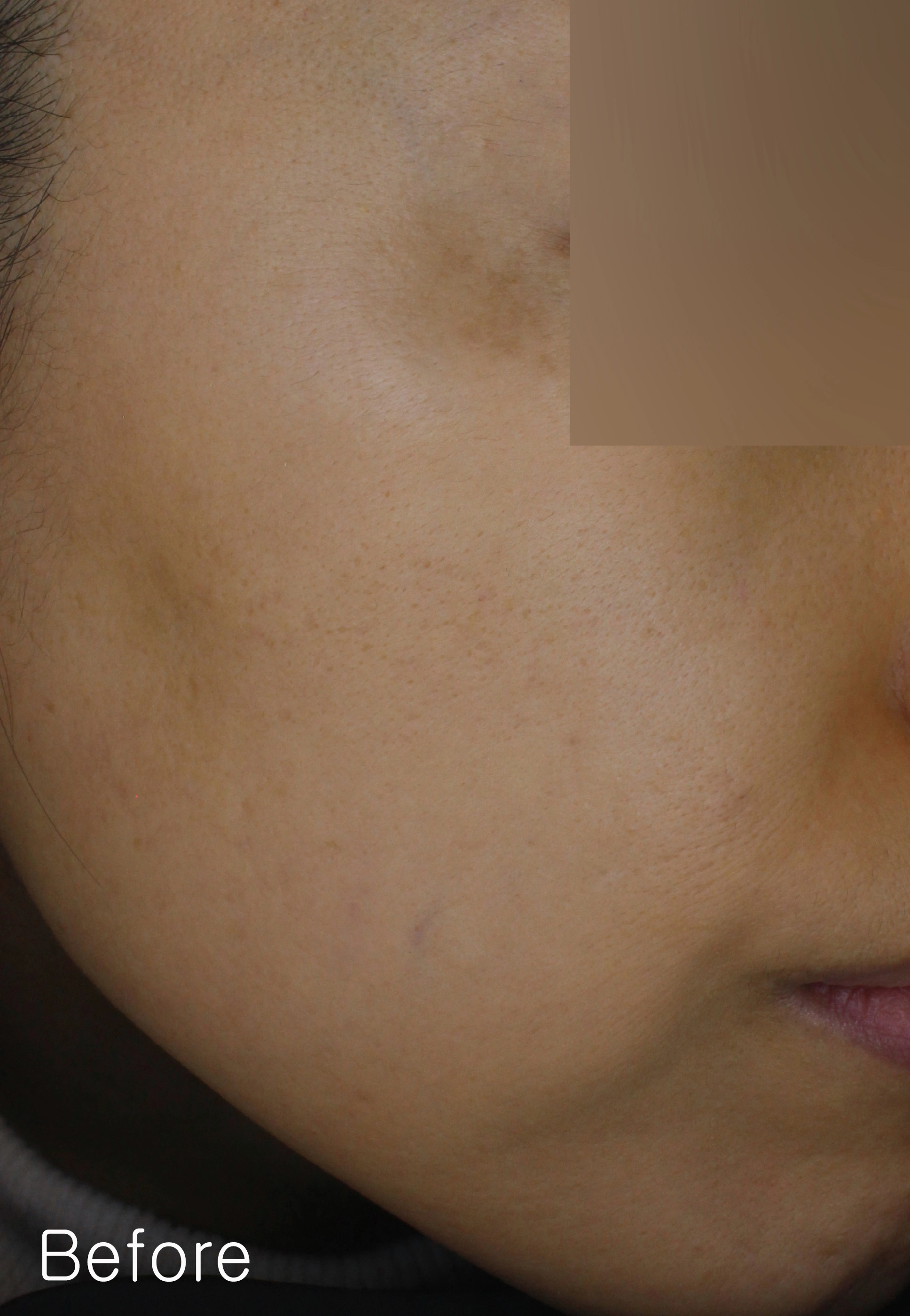 Before image for pore and texture example