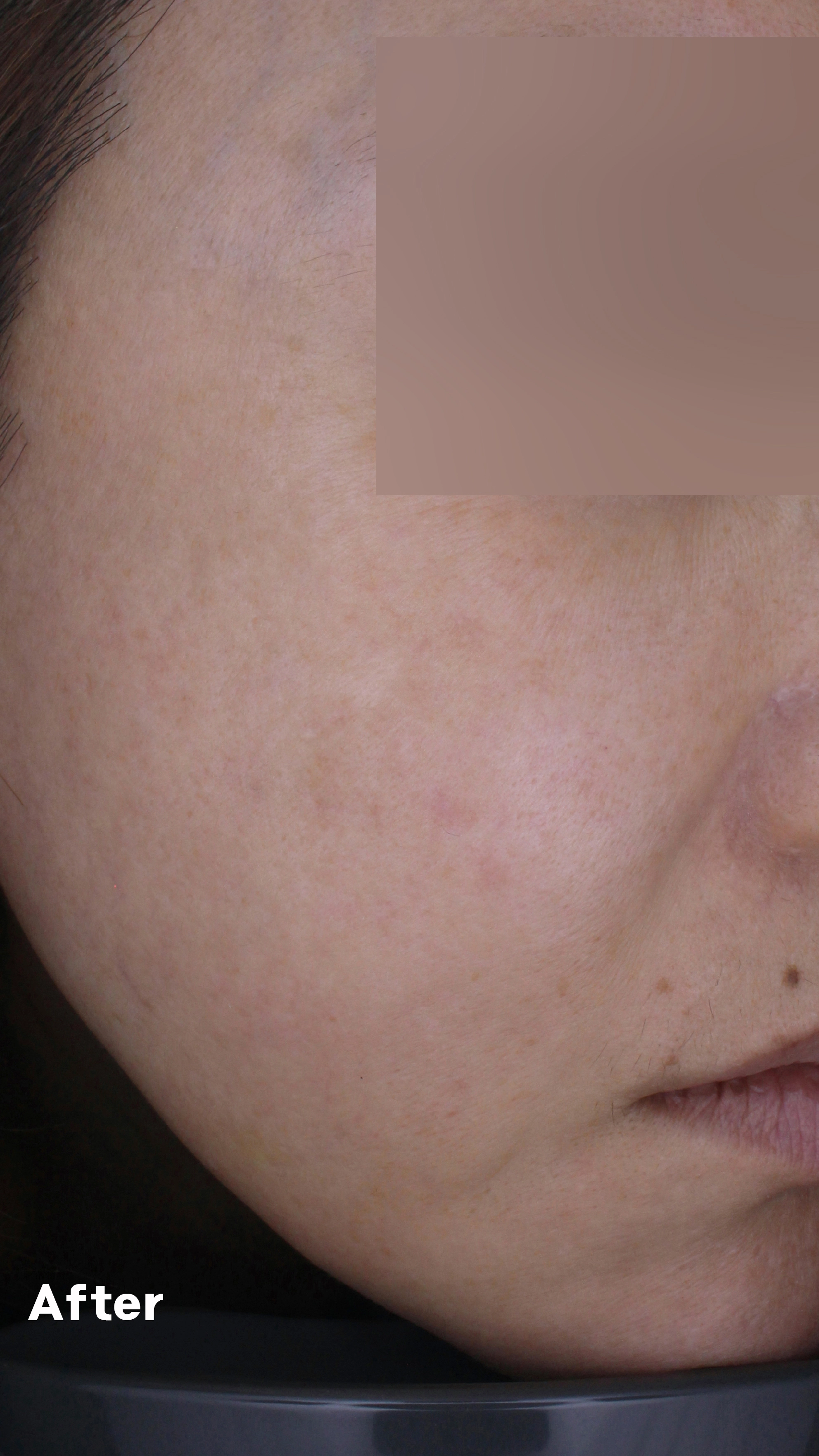 After image for pore and texture example