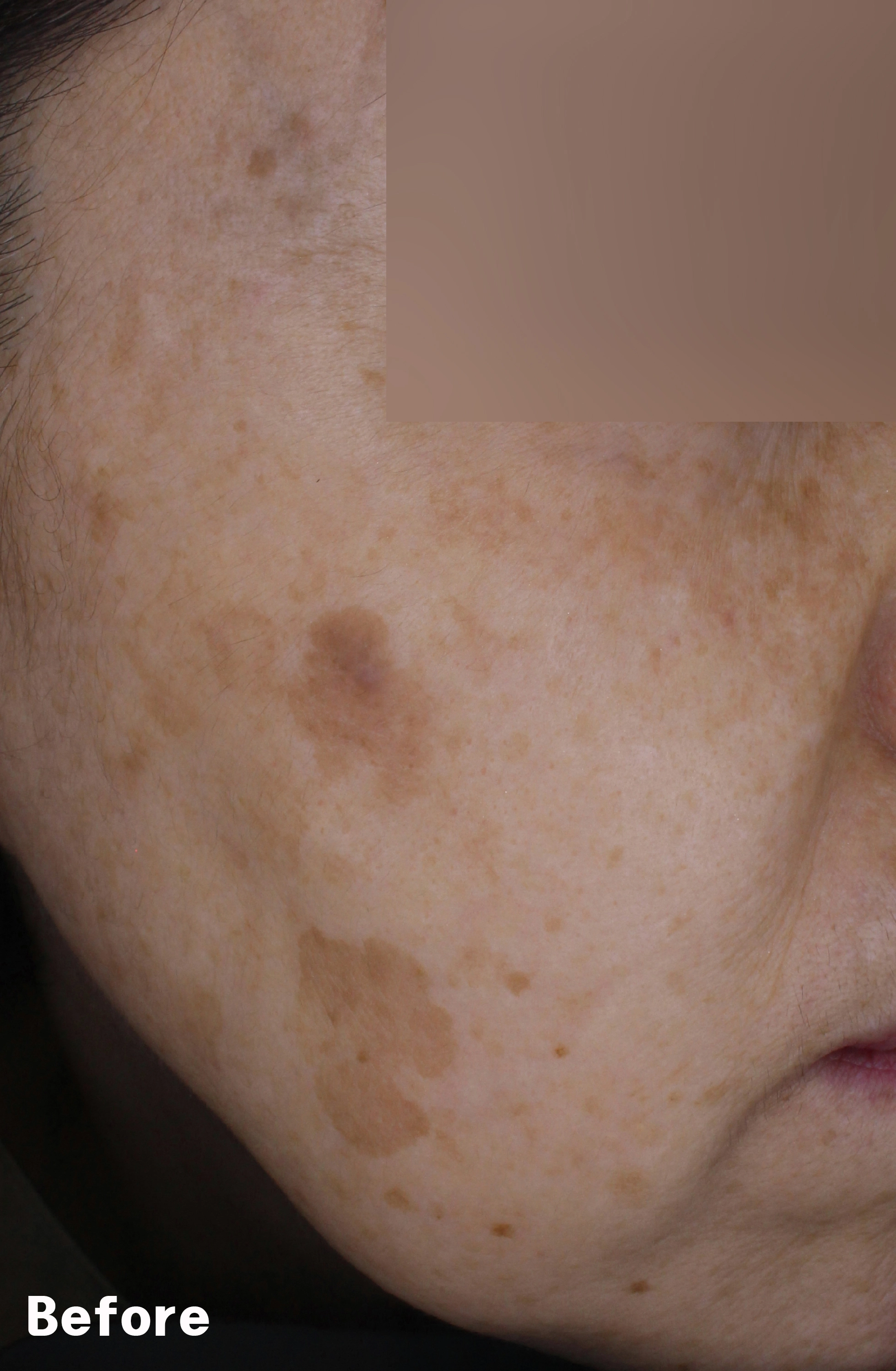 Before image for pore and texture example