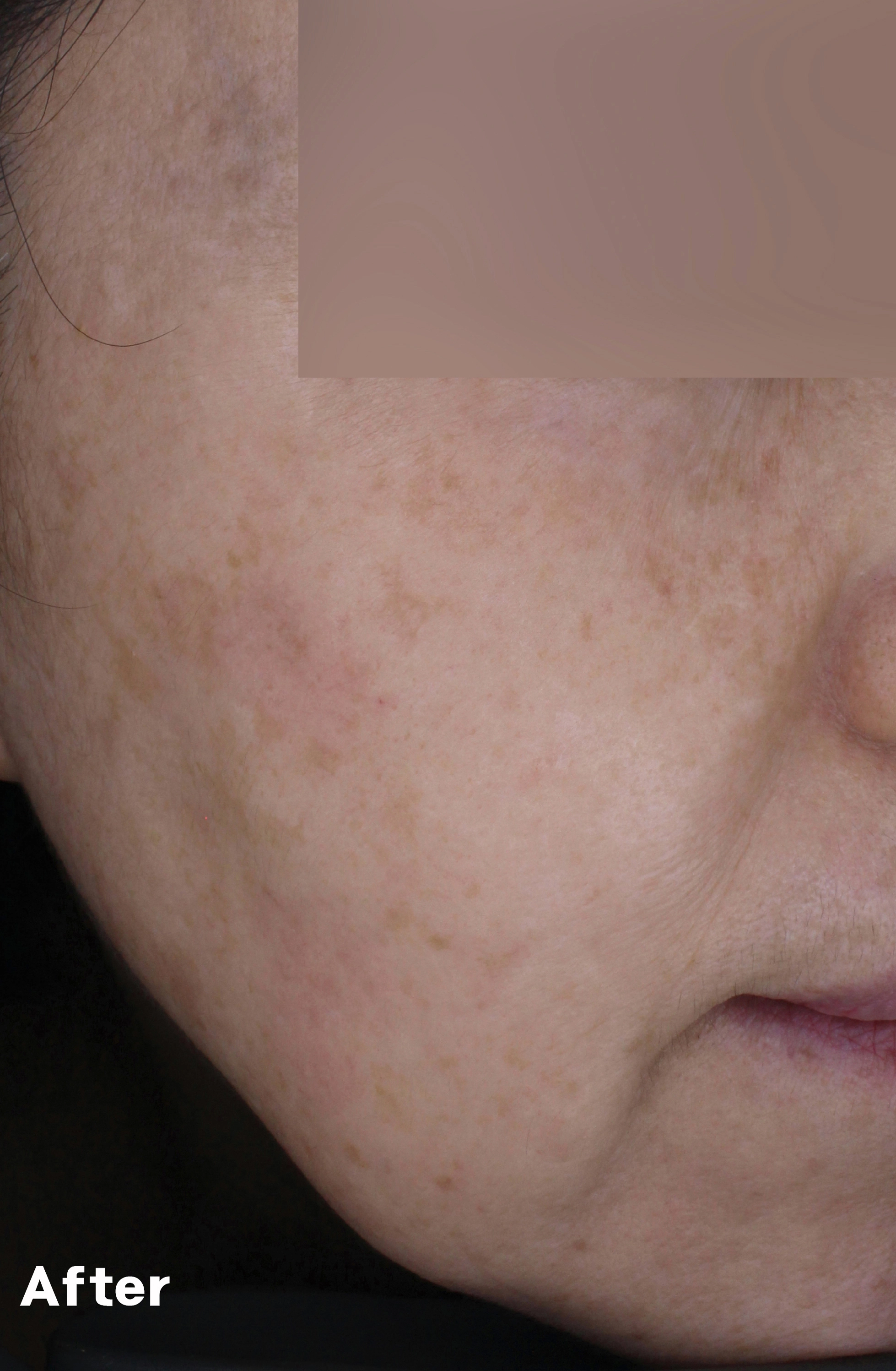 After image for pore and texture example