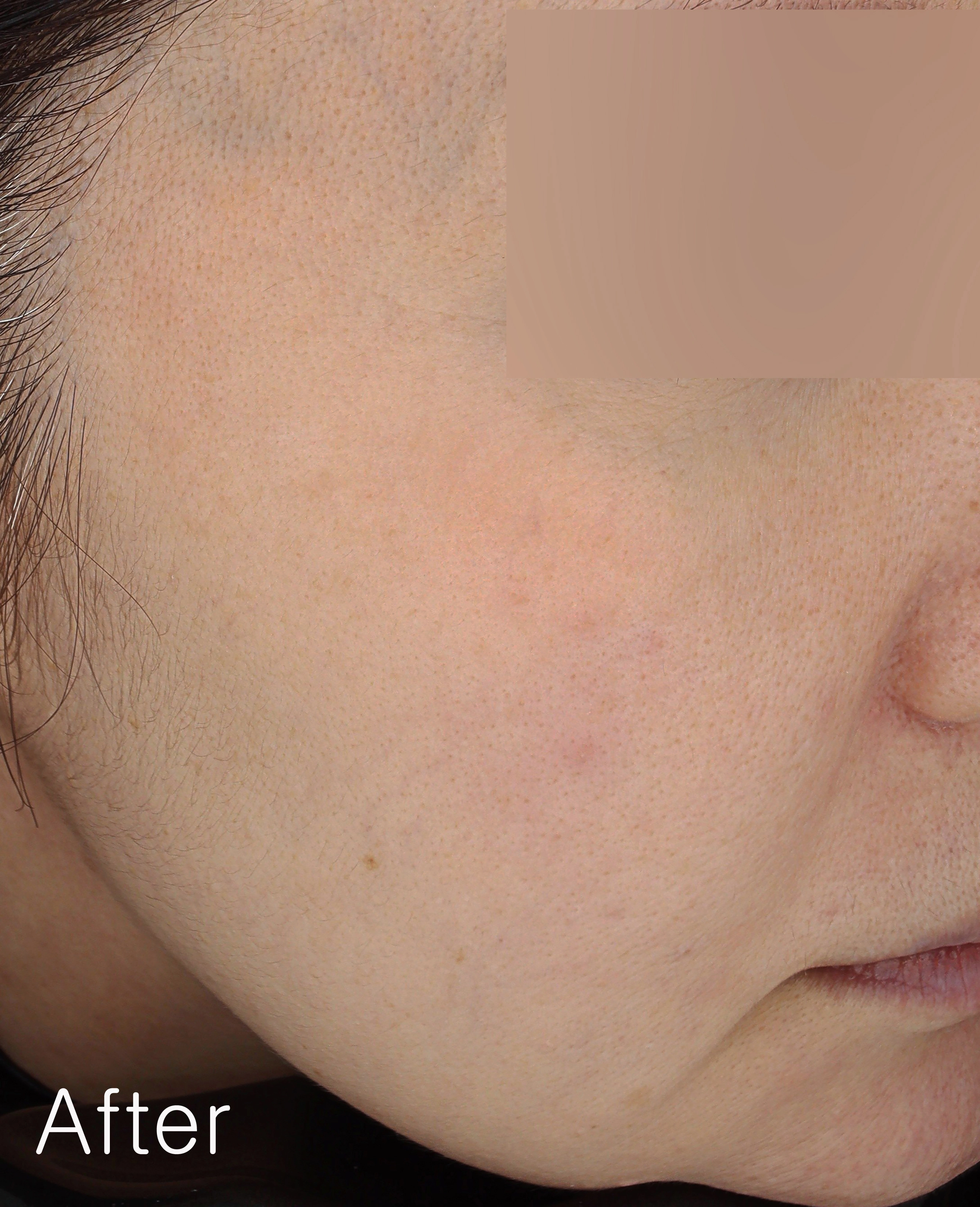 After image for pore and texture example