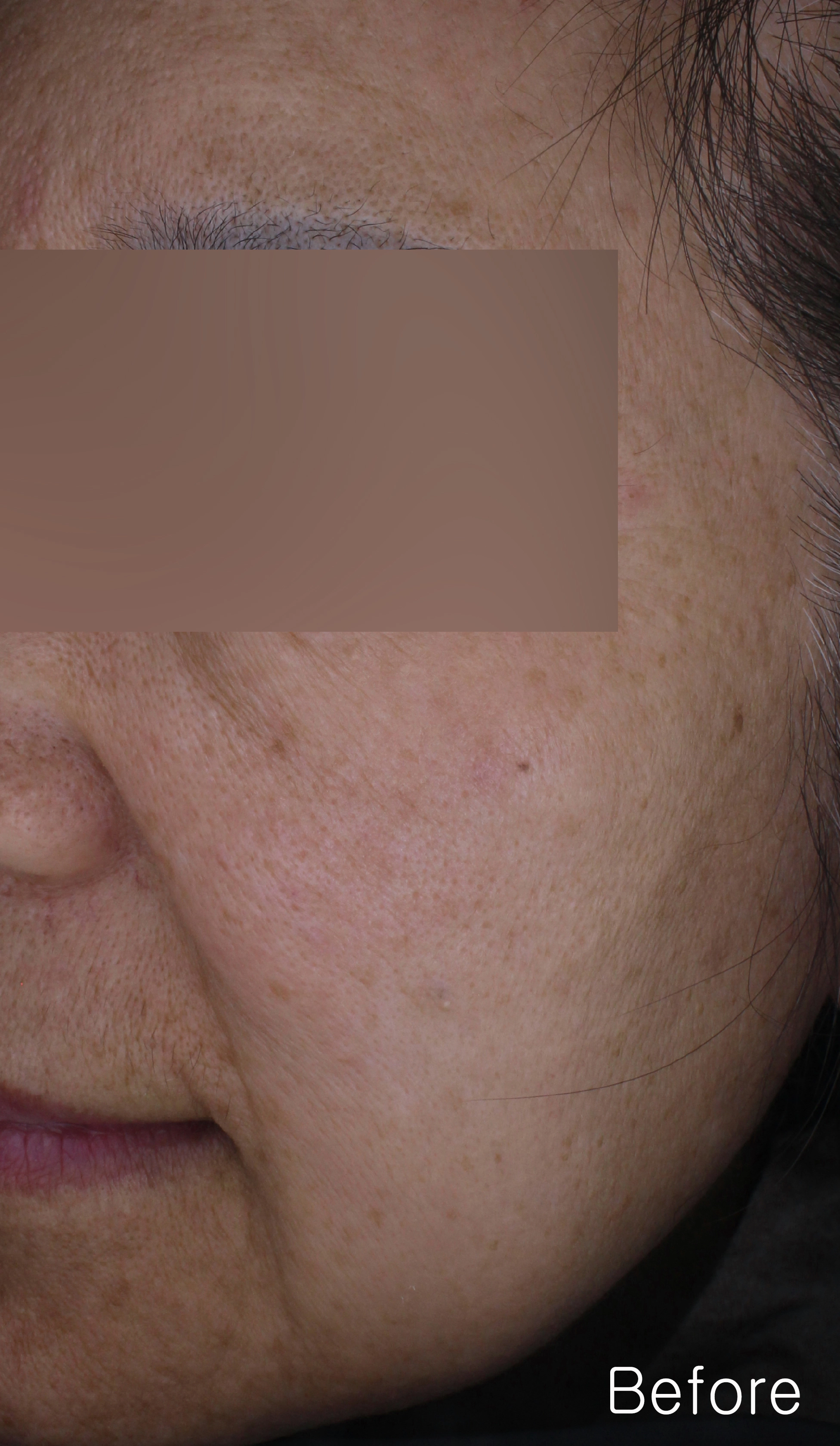 Before image for pore and texture example