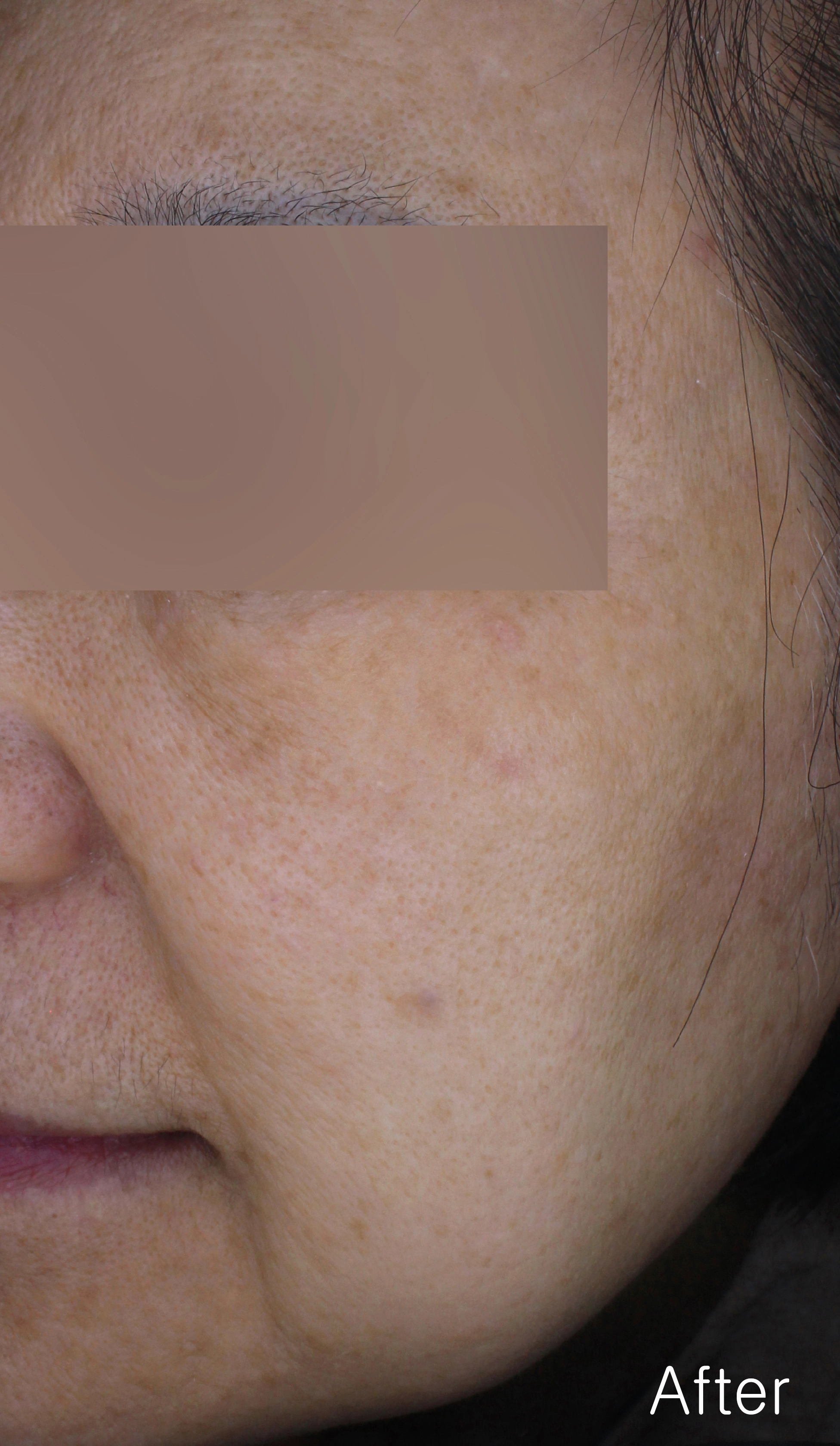 After image for pore and texture example