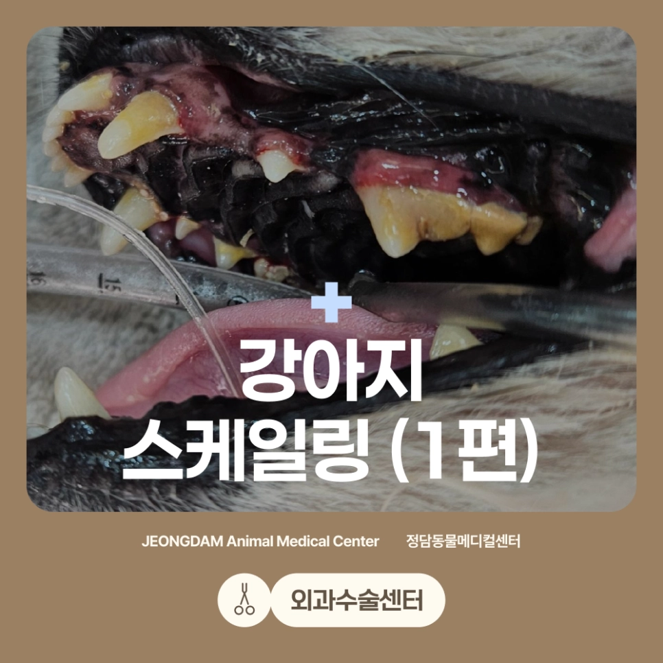 스케일링 치료