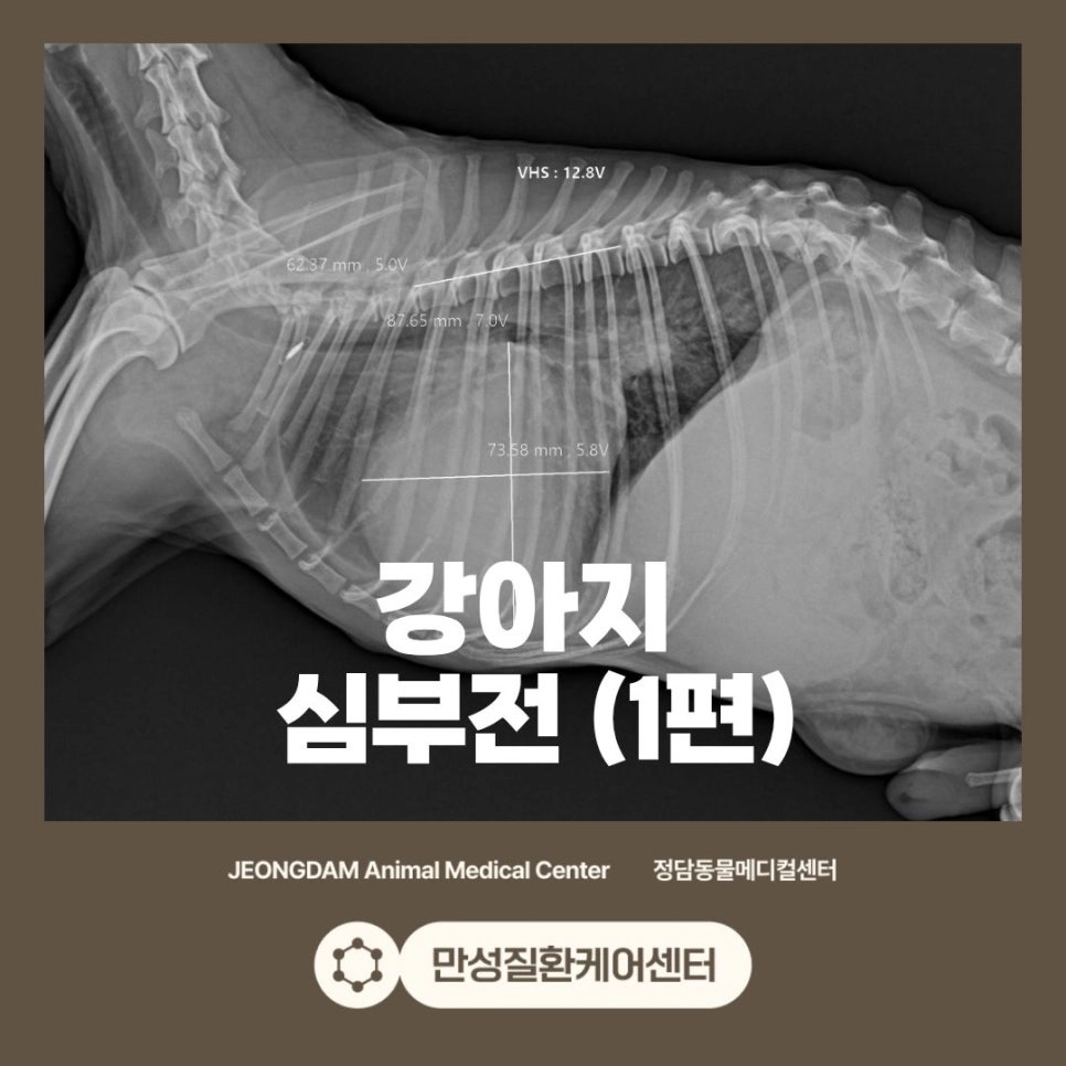 심부전 치료 사례