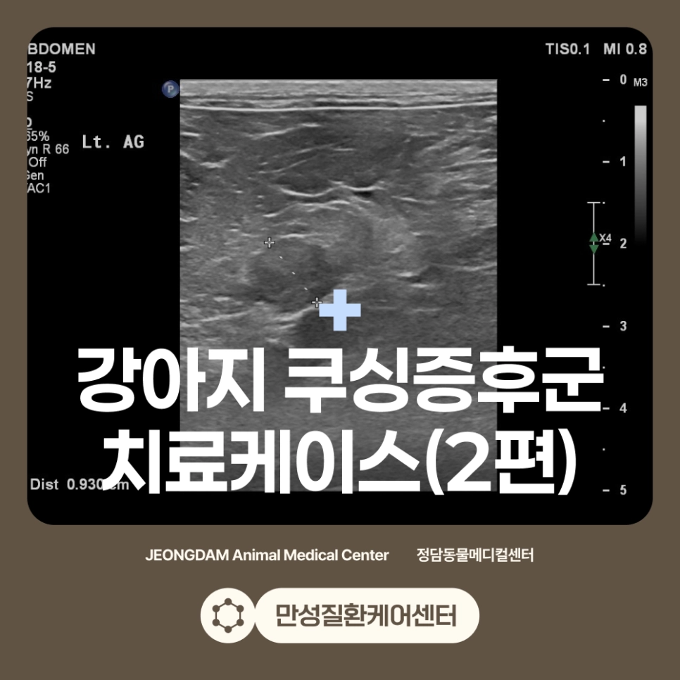 쿠싱증후군