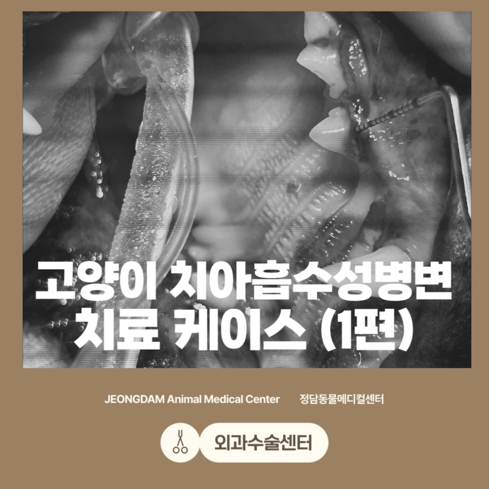 치아흡수성 병변 치료 사례