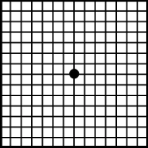 normal vision