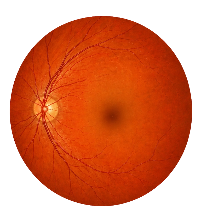 정상