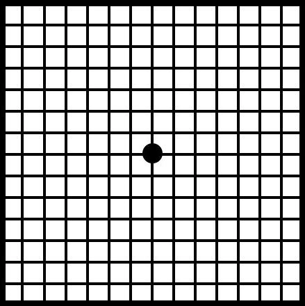 normal vision