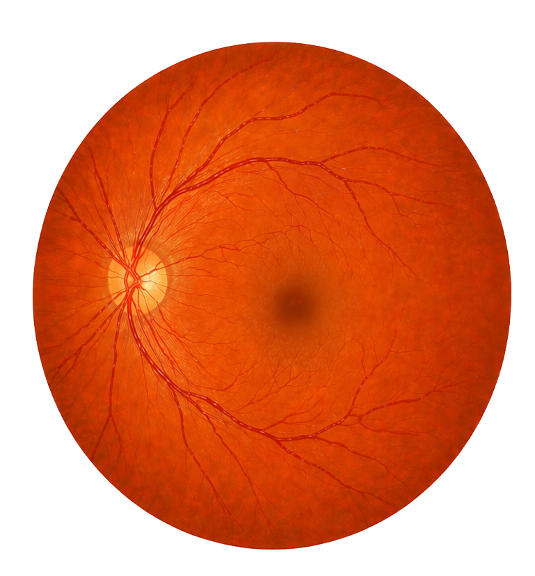 정상